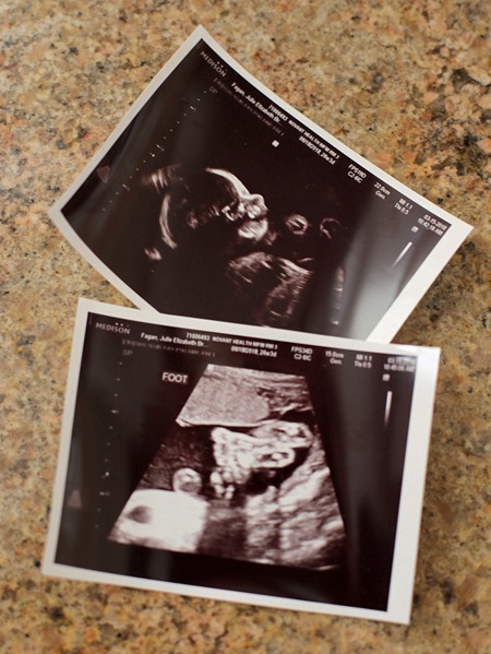 26 week ultrasound